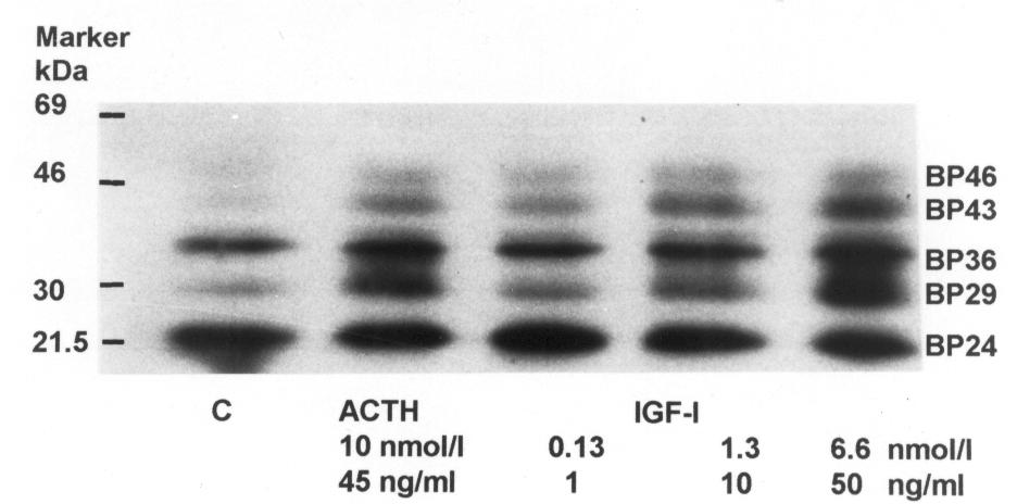 Abbildung 21: Regulation der IGFBP-Sekretion von 1x10 6 humanen NNR-Zellen während der ersten 24 Stunden unter den angegebenen Bedingungen, analysiert im 125 J-IGF-Liganden-Blot.