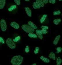 Anti-DFS70-Muster in der IIFT: feingranulär mit positiven Chromosomen-Regionen Anti-DFS70-ELISA (EA 159z) Schneller,