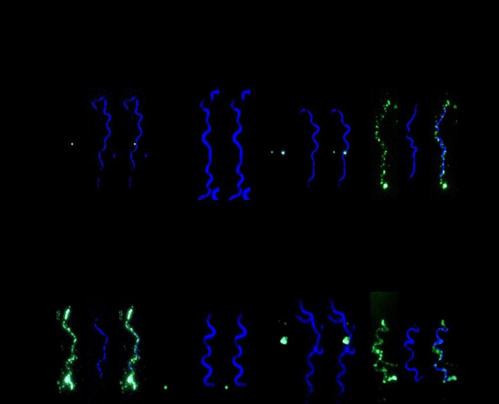 Anhang Abb. IV: Lokalisation von CRASP-3 (A) und CRASP-5 (B) auf der Zelloberfläche von transformierten B. garinii G1-Zellen. Intakte Zellen der Isolate B. burgdorferi LW2, B.
