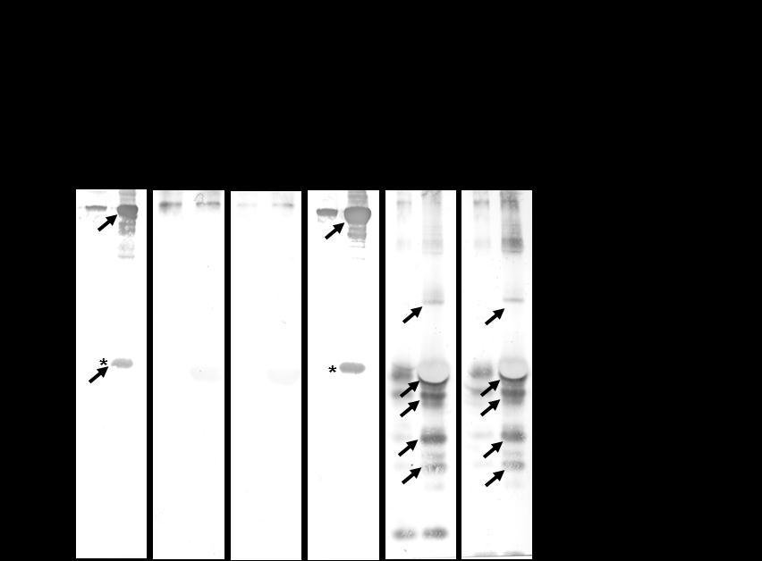 Anhang Abb. V: Nachweis von interagierenden Serumproteinen mit CRASP der Isolate B. burgdorferi LW2 und verschiedener Transformanten mittels polyklonalem anti-faktor H-Antikörper.