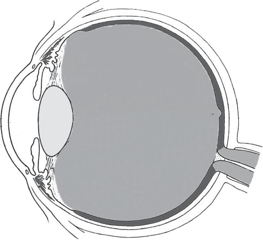 Abbildung 2.2 Querschnitt durch das menschliche Auge. Das von einem Objekt reflektierte Licht wird durch die Linse gebündelt. Wird das Objekt fixiert, liegt es auf der Sehachse, d. h.