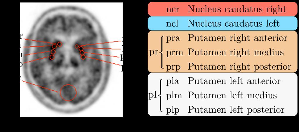 Methodik Quantitative Auswertung 8 ROIs (3D) innerhalb des Striatum + 1 ROI