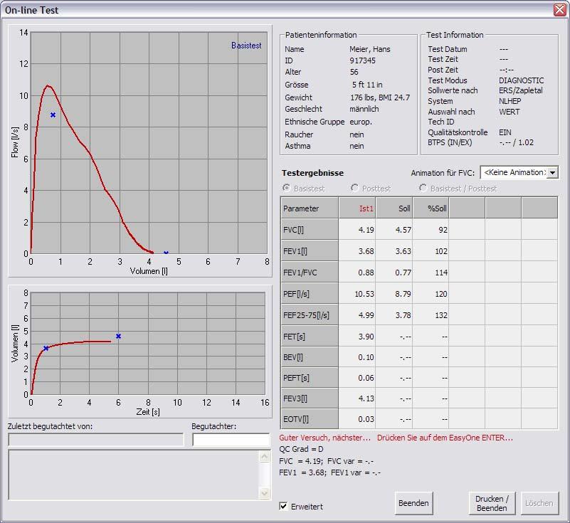 2030434-002 Rev. A Seite 15 Am Ende des Spirometriemanövers erscheinen links auf dem Bildschirm die kompletten Fluss-Volumen- und Volumen-Zeit Kurven, rechts sind die Messwerte dargestellt.
