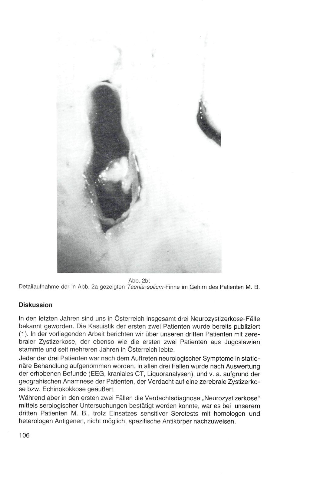 Abb. 2b: Detailaufnahme der in Abb. 2a gezeigten Taenia-solium-Fmne im Gehirn des Patienten M. B.