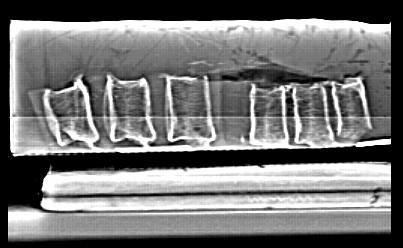 Material und Methoden 27 3.2.1.1 Bestimmung der Knochendichte Abbildung 3-4: Seitliches Scanogramm von BWK 10 und LWK 4, an dem die Planung der weiteren Bildgebung erfolgte.