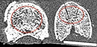 Material und Methoden 34 Abbildung 3-11: Zwei Wirbelkörper mit den Regions of Interest: rechts wurde der dorsale Teil wegen des einmündenden Venenplexus nicht miteinbezogen.