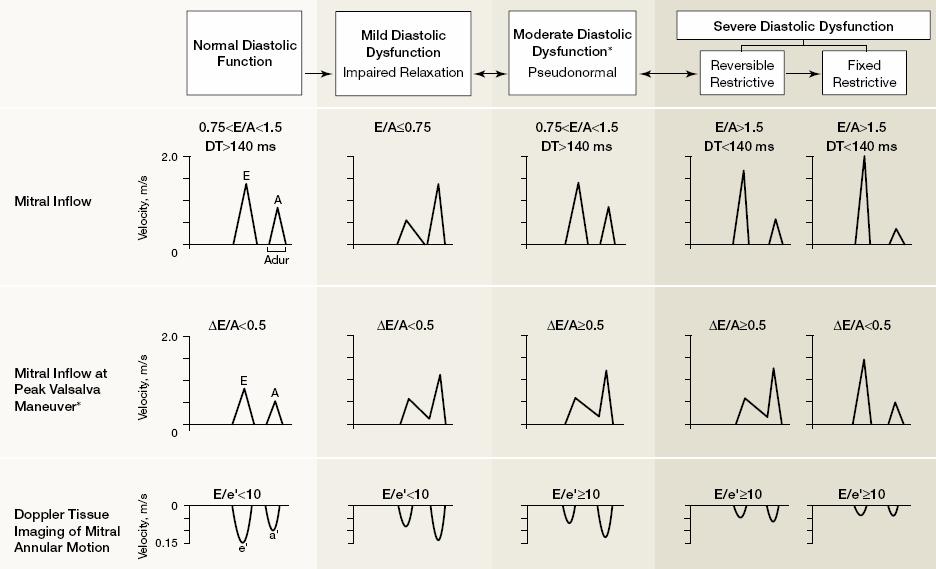 Abbildung 1: Dopplerkriterien zur Klassifikation der diastolischen Funktion nach Redfield et al. (Redfield et al., 2003)