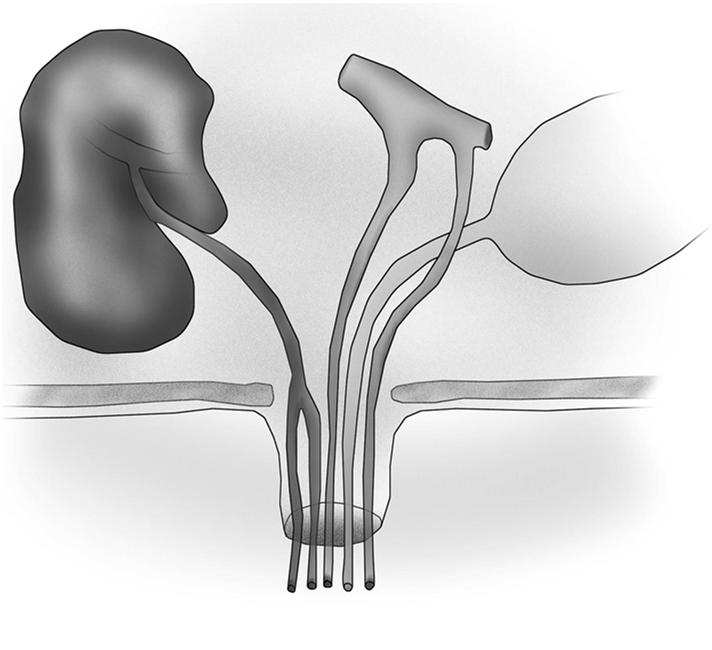 Aufbau der Nabelgefäße - Anatomie Leber Aorta Arterien Blase Vene Urachus innerer Nabel äußerer Nabel Ursachen Nabel zu kurz abgerissen unreif geborene Tiere - zu weite Nabelöffnung unvollständiger