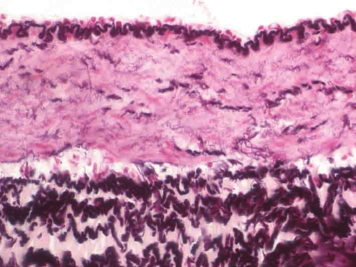 der Tunica interna fein verzweigte elastische Fasern zwischen glatten Muskelzellen