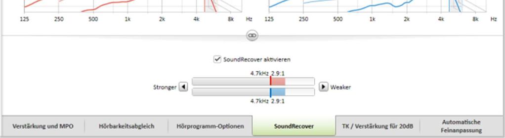 20 nummeriert sind. Die verfügbaren Bereiche innerhalb jeder Skala sind sichtbar. Es ist auch ein vollständig individuell einstellbares Programm als zusätzliches Programm erhältlich.