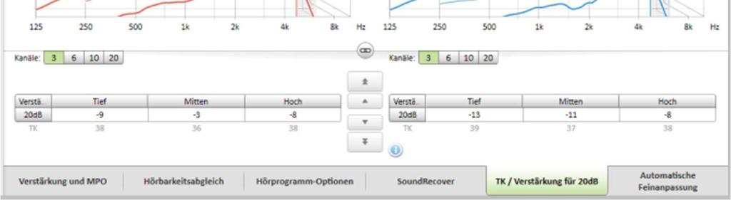 NEU: SoundRecover kann nun noch individueller eingestellt werden, indem die Grenzfrequenz und Kompressionsrate getrennt voneinander angezeigt werden.