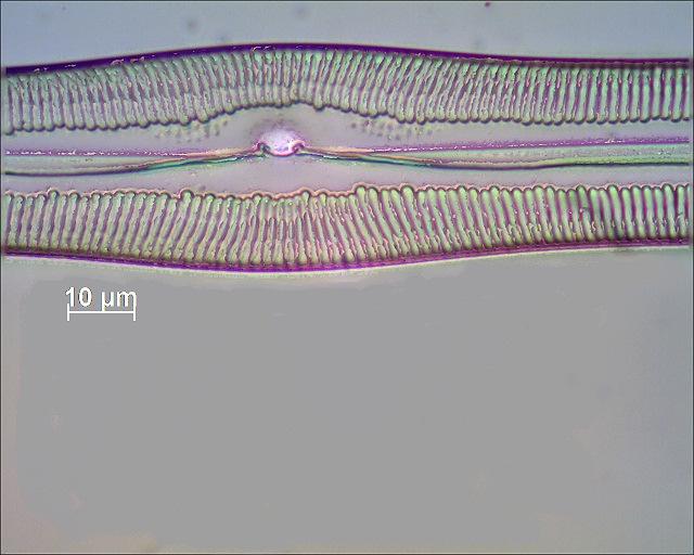 Es wurde jeweils ein Stapel von 10 Bildern fotografiert und mit Picolay bearbeitet. Die erste Diatomeen von links im mikroskopischen Bild. ND-3.