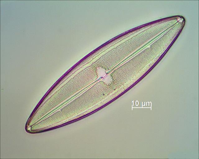 Die elfte Diatomeen von links im mikroskopischen Bild. ND-3.