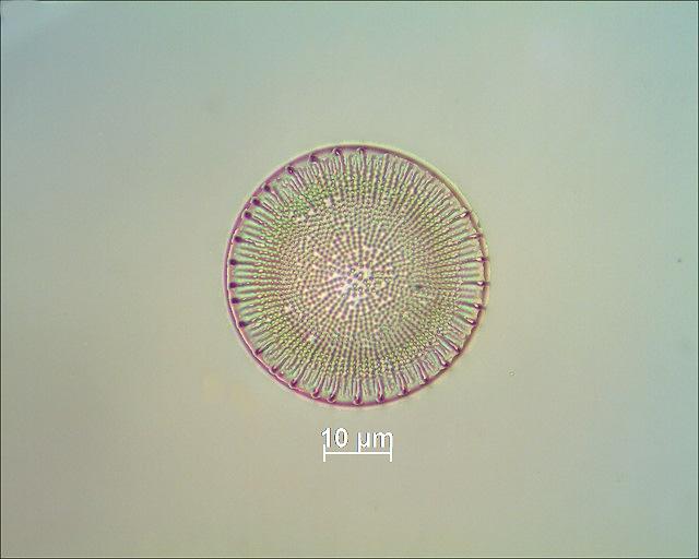 Die zwölfte Diatomeen von links im mikroskopischen Bild. ND-3.