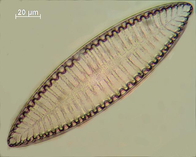 Die vierte Diatomeen von links im mikroskopischen Bild. ND-3.4 40/0,65 Achromat von Müller Länge: 180µm; Breite: 54µm Die Schale ist in der Aufsicht elliptisch.