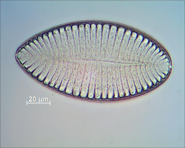 Die fünfte Diatomeen von links im mikroskopischen Bild. ND-3.