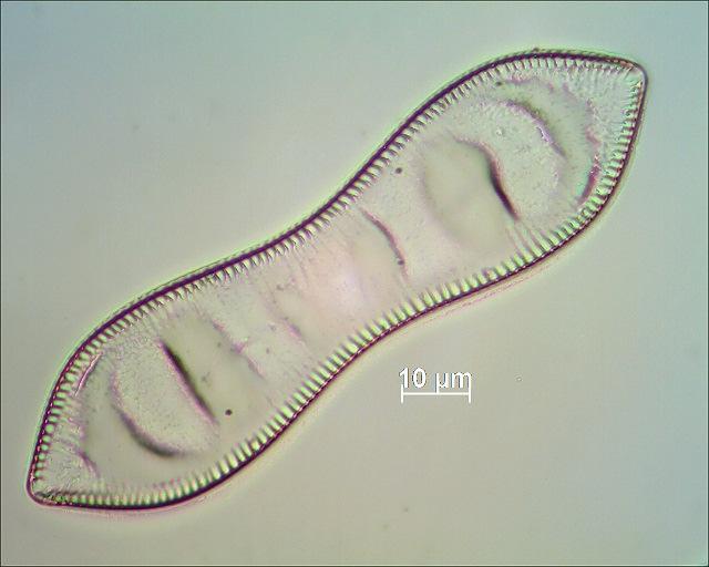 Die achte Diatomeen von links im mikroskopischen Bild. ND-3.