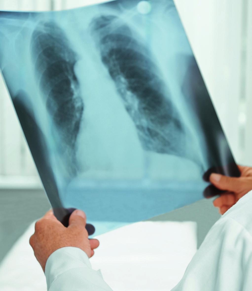 Bayerisches Landesamt für Gesundheit und Lebensmittelsicherheit Tuberculosis Timely detection