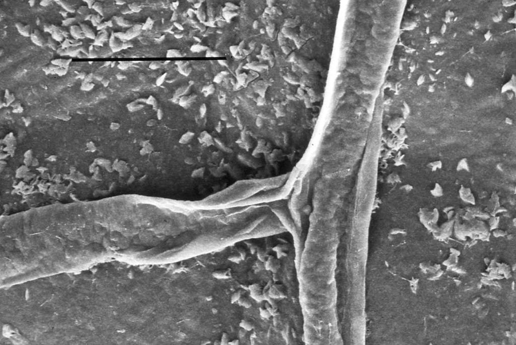 Sporen  Mycel