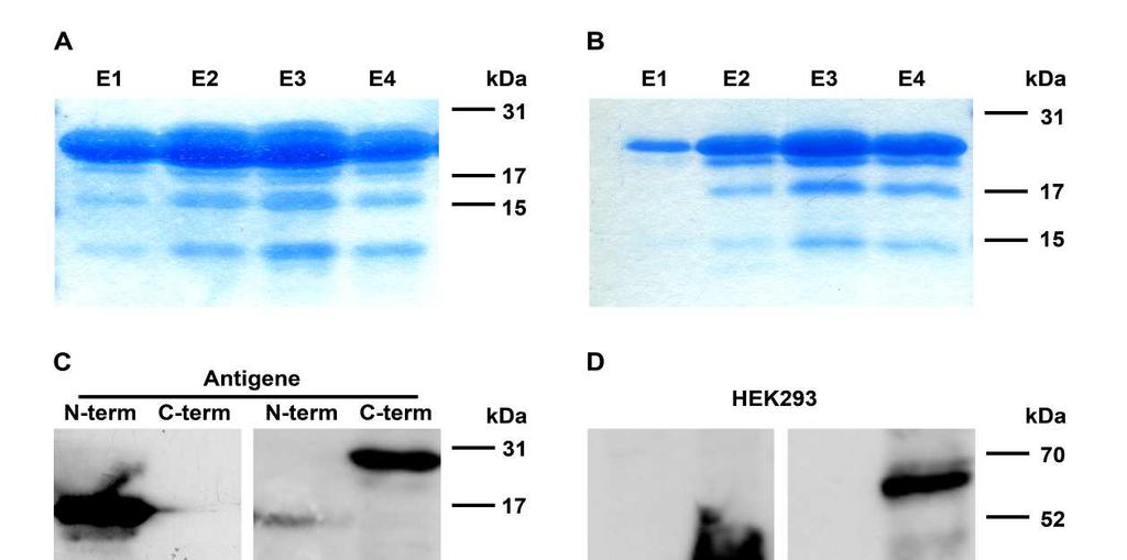 Ergebnisse Abbildung 25: Kontrolle der eluierten Antigene und Western Blots zur Charakterisierung der generierten Myrf-Antikörper Mit Coomassieblau gefärbtes SDS-Gel, beladen