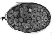 mm Embryo von Dactylorhiza