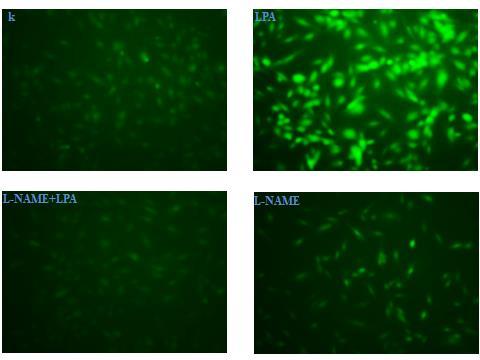 Ergebnisse gleichzeitige Stimulation der HPAECs mit 10 µm LPA und dem enos-inhibitor L-NAME (100 μm) für 30 min zeigte sich eine signifikante Verminderung der Fluoreszenz im Vergleich zu dem