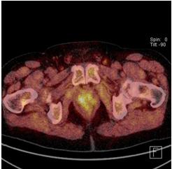 Contrast-enhanced magnetic resonance imaging