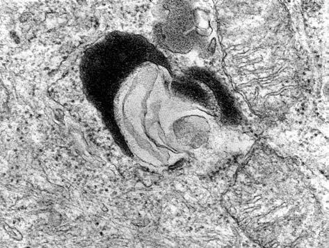 Die euchromatischen Kerne enthielten oft mehrere (zwei bis drei) große Nukleoli. Tiefe Einfaltungen kennzeichneten das Profil der Zellkerne.