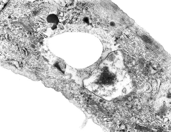 GF V Nk GF A L rer rer B Abbildung 33 Ultrastruktur boviner Endothelzellen aus dem Corpus luteum der Kultur BCl