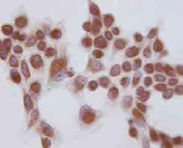 BCl AA BCl RN BCl RA1 BCl RA2 Abbildung 45 Immunzytochemischer Nachweis von CD31 in Endothelzellen des bovinen Corpus luteum nach 3 Tagen
