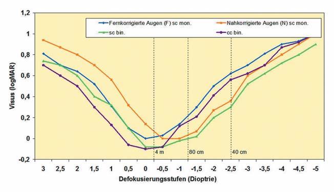 1200 Abb. 4 Defokuskurven (Mediane) monokular und binokular im Vergleich. F sc mon.: monokular unkorrigierter Defokusverlauf der fernkorrigierten Augen, N sc mon.