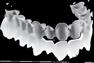 KRONEN- UND BRÜCKENPROTHETIK Wirobond C+ Kobalt-Chrom-Restaurationen aus dem SLM-Verfahren Das Selective Laser Melting-Verfahren von BEGO, miterfunden und für den Dentalbereich patentiert, bietet