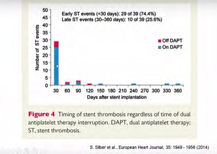 DAPT (Duale Anti-Plättchen Therapie) Möglichst kurz oder möglichst lang ESC-Leitlinien
