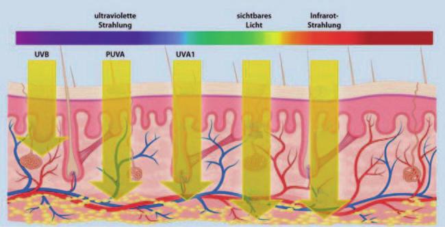 10 2 Wirkmechanismen und Anwendungsgebiete der Phototherapie Abb. 2.1 Photobiologische Effekte elektromagnetischer Strahlung. (Modifiziert nach Berneburg et al.