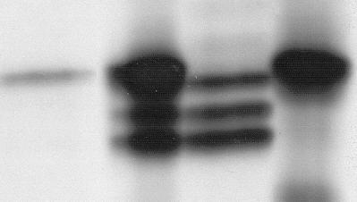 sinensis in Hundepankreasmikrosomen. Autoradiographie der radioaktiv markierten Proteine nach gelelektrophoretischer Auftrennung im SDS-PAA-Gel.