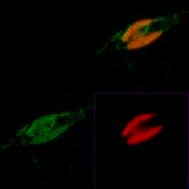 Ergebnisse A) t-ssu1gfp B) t-ssu3gfp Abbildung 3-18 CLSM-Aufnahmen von Transformanden mit Transportsequenzen aus Euglenophyten CLSM-Aufnahmen von Phaeodactylum-Zellen, die nach Transformation die