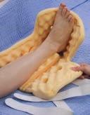 Patienten-Freundliche Heelift Eigenschaften Gesteppte Kante: Die gesteppte obere Kante verengt den Raum für den vorderen Fuß und die Rückfederung verstärkt die Stützwirkung.