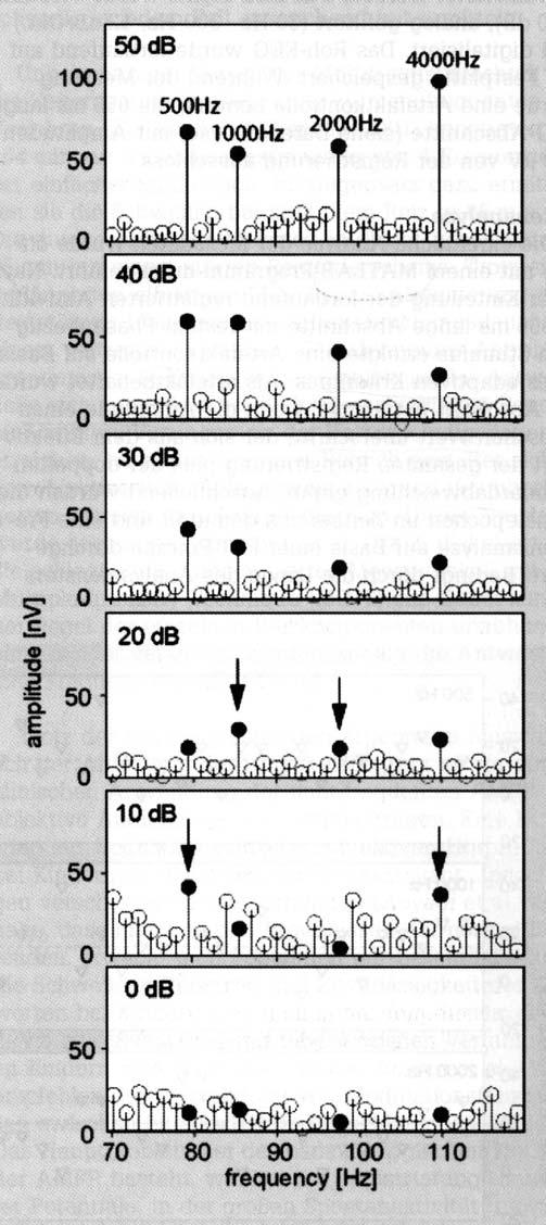 Lux L, Pethe J, Mühler R, von Specht H (2003) Bestimmung der Hörschwelle durch Registrierung von Amplitude Modulation Following