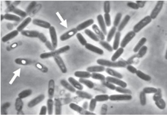 Was ist das Problem mit Bacillus cereus?
