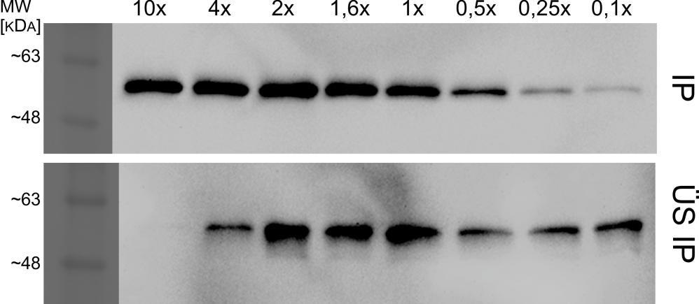 4. Ergebnisse Abbildung 4-13: Anti-myc-Western Blots von Immunopräzipitations-Experimenten mit konstanter Anti-myc-Antikörpermenge (2 µg) und variierender Menge an Protein G magnetic Beads im Bereich