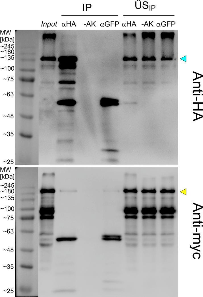 4. Ergebnisse Abbildung 4-16: Western Blots der Immunopräzipitationen von HA:phy4 mit 2 µg und ohne Anti-HA-Antikörper bzw.