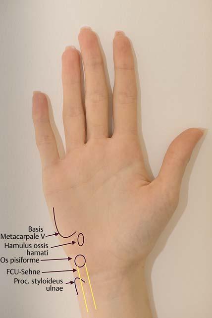 Fortbildung êtfcc 141 Abb.2 a Palpation des Handgelenks: fovea sign. b MRT: Fovea ulnae (sagittal, PD fettgesättigt). Abb.3 Topografie der Hand von palmar.