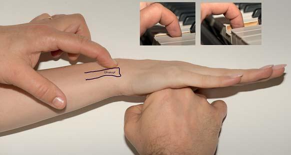 Fortbildung êtfcc 143 wir die flache Hand des Patienten gegen die Hand des Untersuchers drücken.