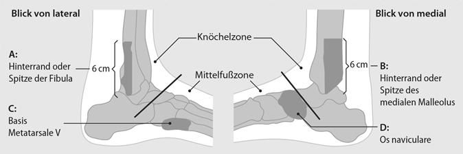 Abb. 2 8 Ottawa-Regeln des Fußes Fußrand bzw. an der Basis des Os metatarsale V sowie über dem Os naviculare durchgeführt werden.
