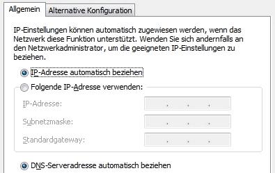 IP-Adresse automatisch beziehen in Windows Vista Der Computer erhält nun eine IP-Adresse von der FRITZ!Box. IP-Adresse automatisch beziehen in Windows Vista 1.