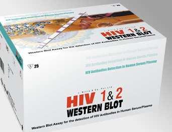 mißlungene Virusnachweis". Es gibt zwei gängige Testverfahren, die beide im Volksmund AIDS-Test" heißen: der ELISA" (s.u.) (auch Suchtest" genannt) und der Western Blot" (auch Bestätigungstest").