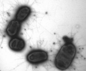 Krankheitserreger entstehen zu lassen. Abb. 2 Typenvielfalt bei E. coli Bakteriophagen, von denen manche auch Stx-Gene tragen und übertragen können. Aufnahme Dr.