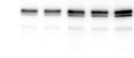 4.4 ABCG2 aus Insektenzellen kda 68 43 1 2 3 4 5 6 Abb. 4.47: Optimierung des zur Proteinexpression von Hi5 Zellen benötigten Volumens der Viruslösung.