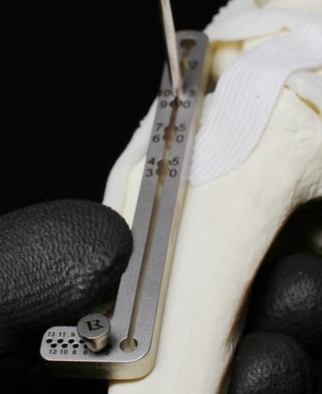 Bringen Sie am Schnittpunkt der cranialen Begrenzung des Femurkondylus und des Tibiaplateaus einen 2.5mm K- Bohrdraht durch die Gelenkskapsel ein.