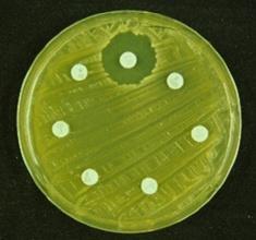 Resistenzen gegen Desinfektionsmittel Kreuzresistenzen zu Antibiotika?